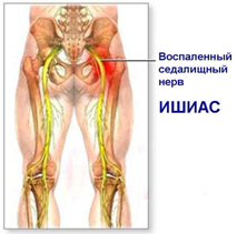 алкоголизм как лечить в домашних условиях - Алкоголизм